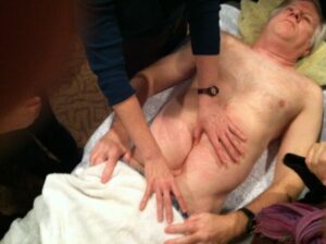 scar tissue release therapy demonstration